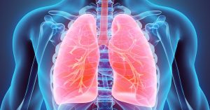 fibrose-pulmonar