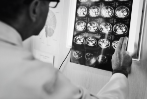 Tumor cerebral 